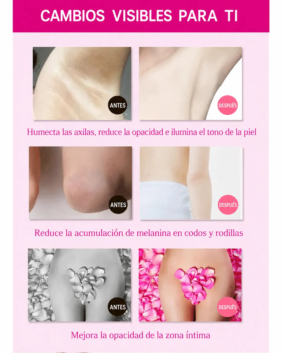 Crema Blanqueadora