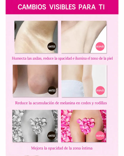 Crema Blanqueadora