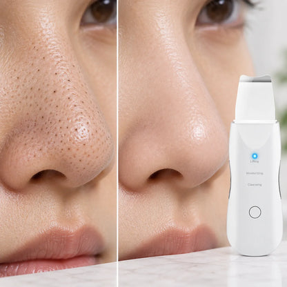 Paleta Ultrasónica Limpiador Facial